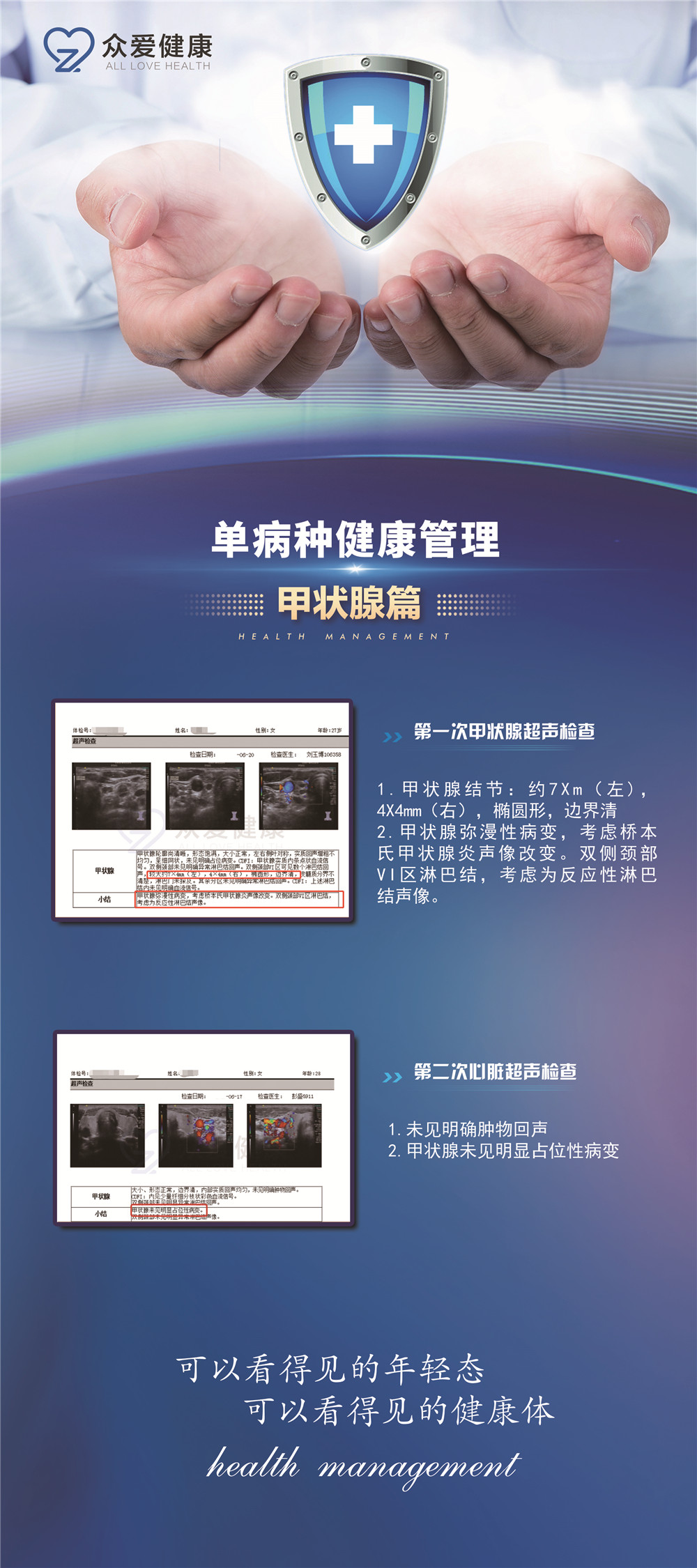 Case study of thyroid ultrasound data