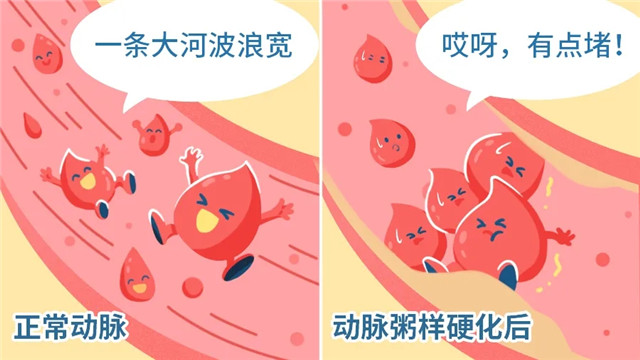 第一批 00 后已经高血脂了！想降脂，这 3 个误区不能踩